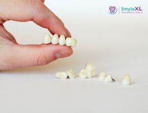 How Much Do Dental Crowns and Bridges Cost? 1 How Much Do Dental Crowns and Bridges Cost?