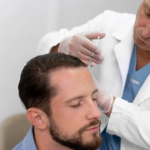 Hair Transplant Clinic in Bangalore: Restore Your Confidence with Advanced Hair Restoration at Anew