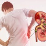 When Should You Visit a Kidney Specialist?