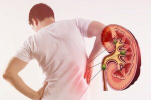 When Should You Visit a Kidney Specialist?