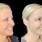 Best Plastic Surgeons in dubai for Botox and Long Lasting Facial Results