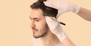 Hair Transplant in Dubai: Recovery Timeline and Tips — What to Expect Week by Week