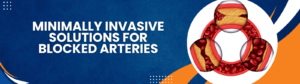 Top Hospital for Angioplasty Treatment in Navi Mumbai – Terna Speciality Hospital & Research Centre