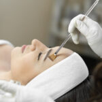 Does PCA Peel Treatment Support Healthier Skin?