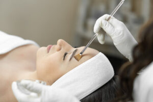 Does PCA Peel Treatment Support Healthier Skin?