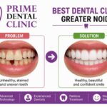 Dentist Greater Noida | Prime Dental Clinic – Advanced Dental Care