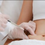 What to Expect During a Lipolysis Injection In Dubai Session