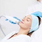Pico Laser Treatment in Dubai5