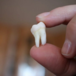 Wisdom Tooth