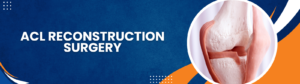 Top-Rated ACL Surgery Treatment in Navi Mumbai at Terna Hospital for Sports Injuries and Knee Ligament Repair 1 Top-Rated ACL Surgery Treatment in Navi Mumbai at Terna Hospital for Sports Injuries and Knee Ligament Repair