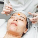 Does PCA Peel Treatment Help With Wrinkles?