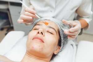 Does PCA Peel Treatment Help With Wrinkles? 1 Does PCA Peel Treatment Help With Wrinkles?