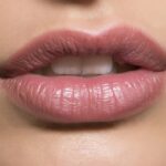 Can Lip Reduction Correct Uneven or Large Lips?