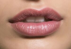 Can Lip Reduction Correct Uneven or Large Lips?
