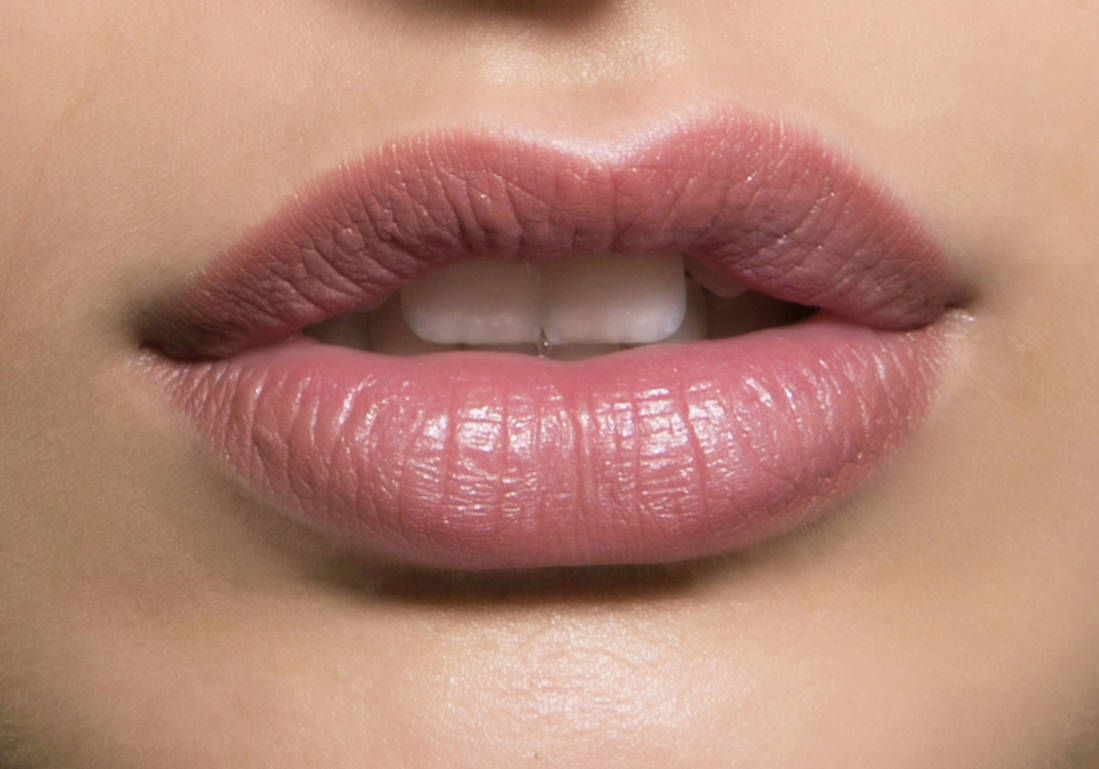 Lip Reduction in Dubai5