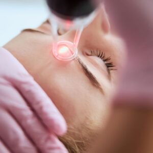 Can Pico Laser Treatment Improve Skin Texture Fast?