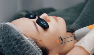 Why Do People Prefer Laser Hair Bleaching Today?