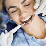 Teeth Cleaning 1