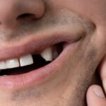 Missing Tooth Treatment2