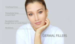 Dermal Fillers in Dubai for Facial Lipoatrophy 1 Dermal Fillers in Dubai for Facial Lipoatrophy