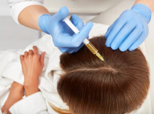 Hair Thinning Solutions Through PRP Hair Treatment in Dubai 1 Hair Thinning Solutions Through PRP Hair Treatment in Dubai