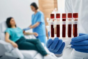What to Expect During Lab Tests At Home In Dubai Appointments
