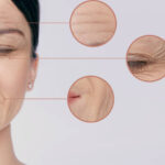 Permanent Results from Facial Capillary Treatment in Dubai