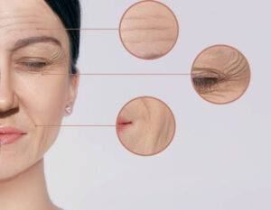 Permanent Results from Facial Capillary Treatment in Dubai