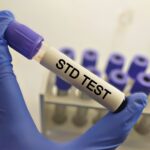 STD Test in Dubai – Essential Screening Guide 3 STD Test in Dubai – Essential Screening Guide