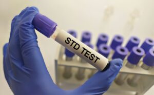 STD Test in Dubai – Essential Screening Guide 1 STD Test in Dubai – Essential Screening Guide