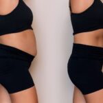 Can Liposuction Support a More Sculpted Silhouette? 3 Can Liposuction Support a More Sculpted Silhouette?