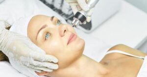 Can Laser Skin Tightening Refresh Tired Looking Skin?