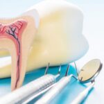 Best Clinic for Root Canal Treatment in Sinhagad Road Pune