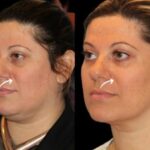 Best Doctors in Dubai for Sculptra Fillers and Beauty Tech Innovation