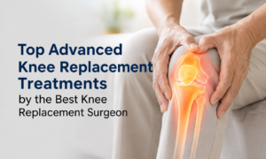 Top Advanced Knee Replacement Treatments by the Best Knee Replacement Surgeon in Lucknow