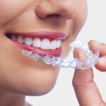 Invisible Braces4