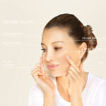 Dermal fillers 31