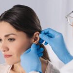 Otoplasty in Islamabad