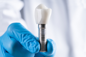 Dental Implants: A Permanent Solution for Missing Teeth 1 Dental Implants: A Permanent Solution for Missing Teeth