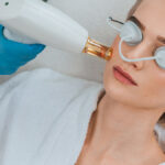 Laser Hair Bleaching in Dubai88