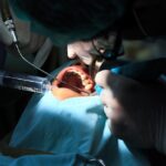 All You Need To Know About Oral And Maxillofacial Surgery 3 All You Need To Know About Oral And Maxillofacial Surgery