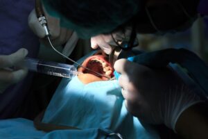 All You Need To Know About Oral And Maxillofacial Surgery