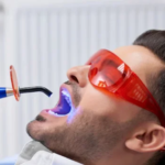 Teeth Whitening 1