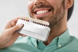 How Dental Veneers Improve Smile and Confidence