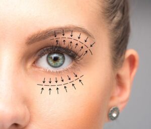 Eyelid Surgery in Islamabad for Droopy Eyelids: What to Expect 1 Eyelid Surgery in Islamabad for Droopy Eyelids: What to Expect