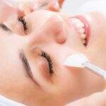 Does PCA Peel Treatment Help Reduce Acne Scars?