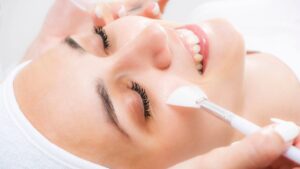 Does PCA Peel Treatment Help Reduce Acne Scars?