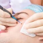Skin Tags Removal in Dubai: Clear and Smooth Skin Solution 3 Skin Tags Removal in Dubai: Clear and Smooth Skin Solution
