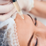 STEM CELL THERAPY 1 861x1024 1