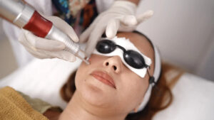 Signs You May Need CO2 Skin Resurfacing in Islamabad
